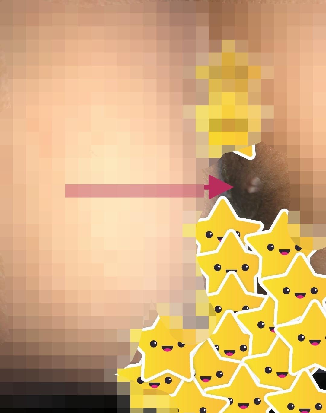 插图1